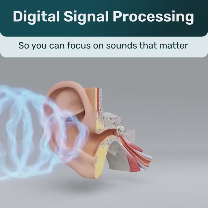 WiseHear CIC rechargeable earpieces — product video 3